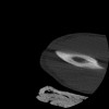 SPORK, NICO - 22.03.1976 - 02.08.2022 - CT obere Extremität - 17:51:17